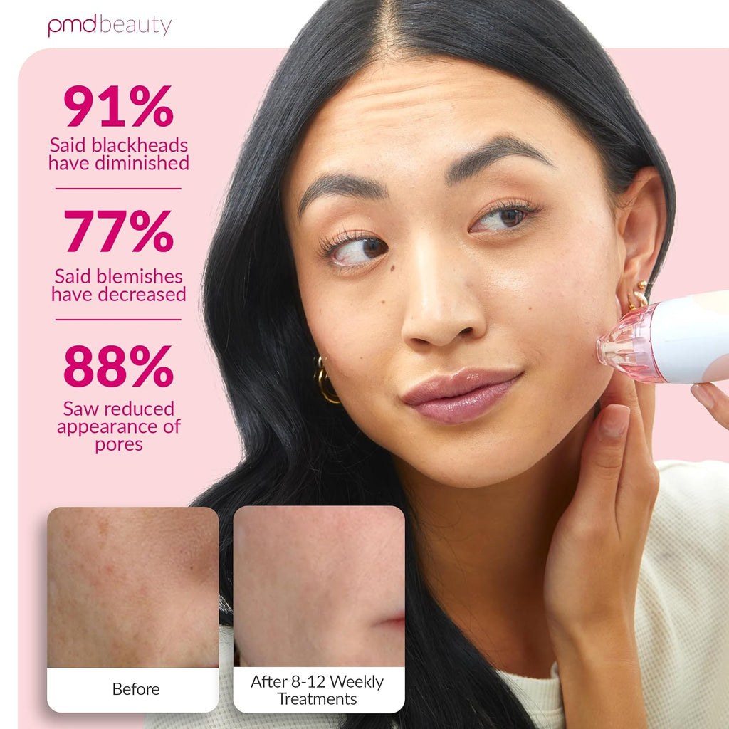PMD Beauty Personal Microderm Classic - At-Home Use, Facial Exfoliator Tool, Microdermabrasion Machine Kit for Face and Body Skincare