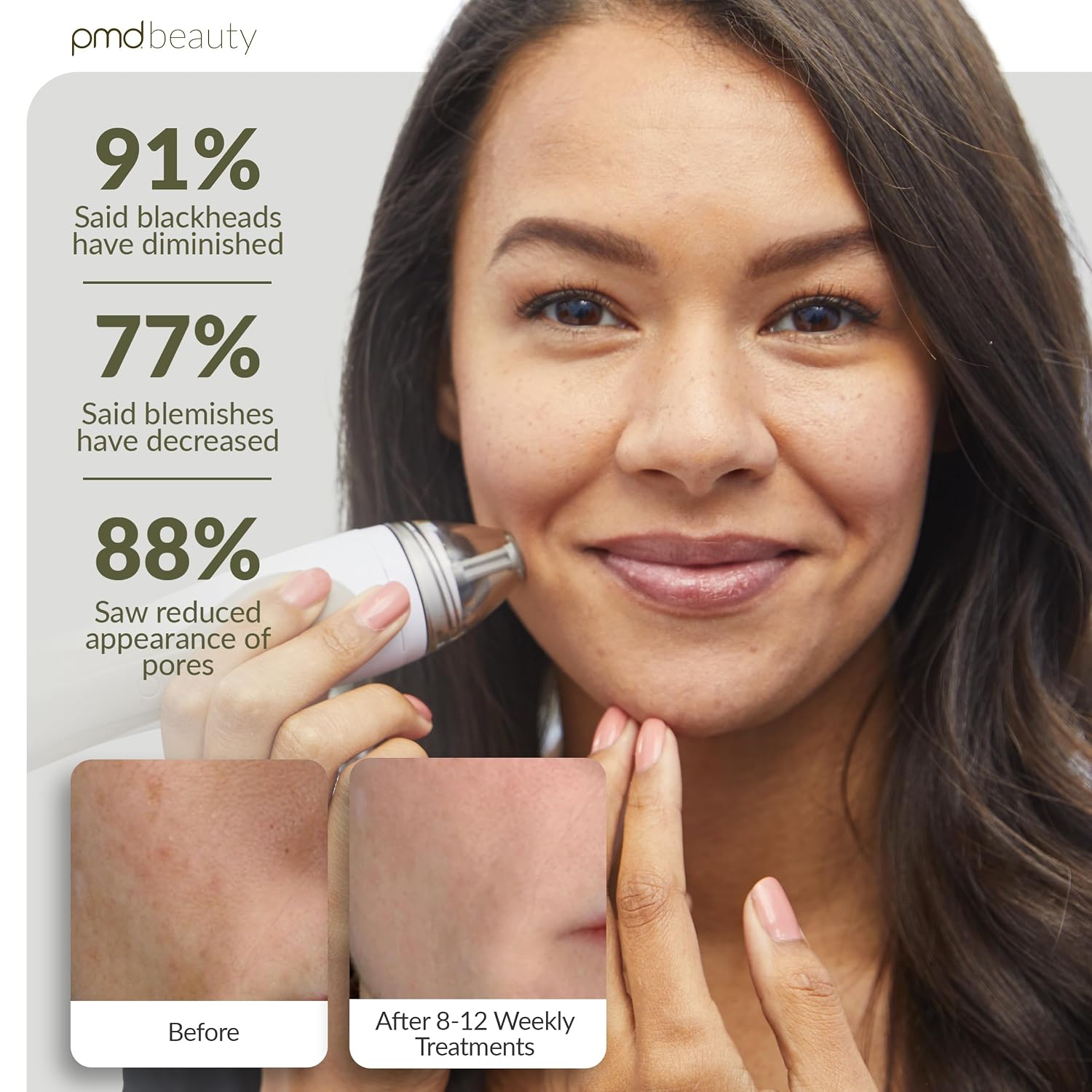 PMD Beauty Personal Microderm Pro - At-Home Use, Facial Exfoliator Tool, Microdermabrasion Machine Kit for Face and Body Skincare