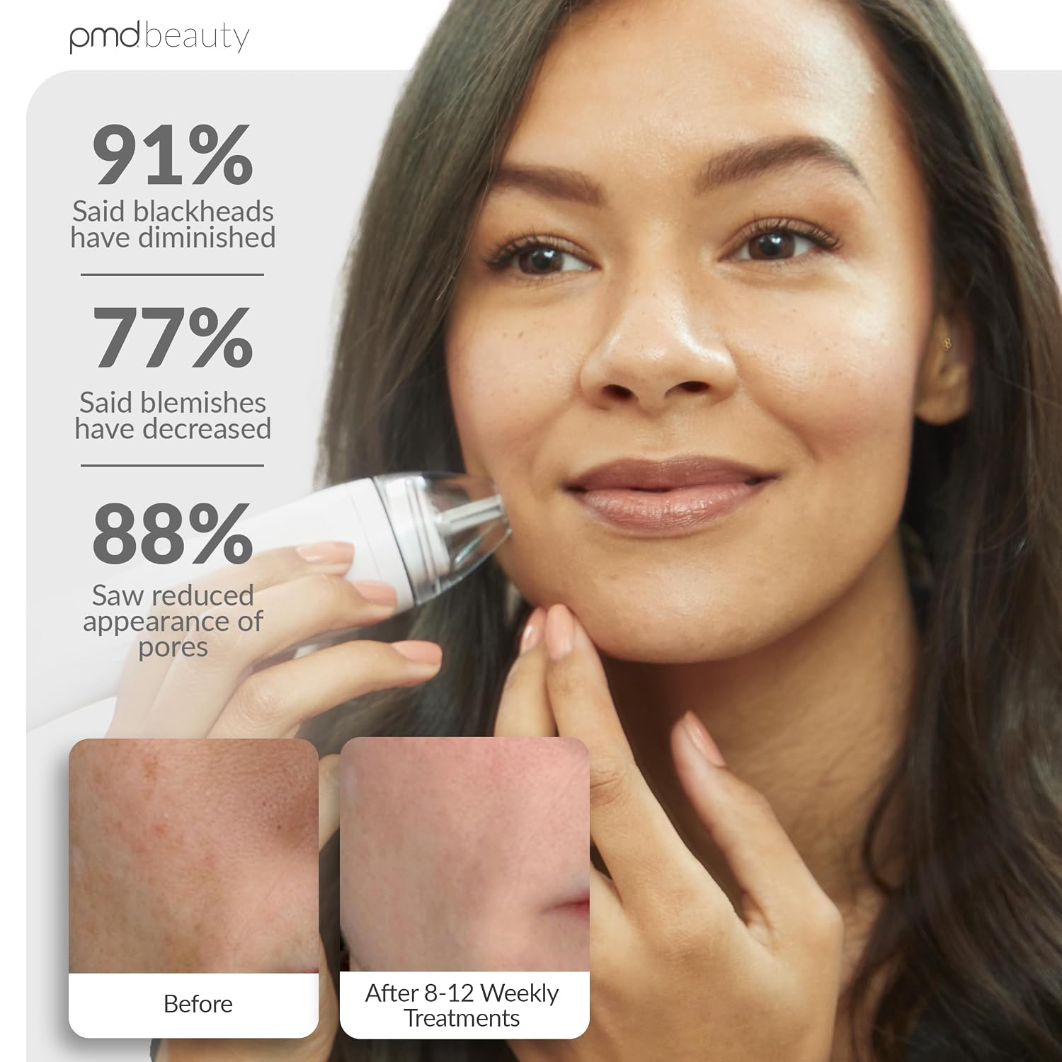 PMD Beauty Personal Microderm Pro - At-Home Use, Facial Exfoliator Tool, Microdermabrasion Machine Kit for Face and Body Skincare