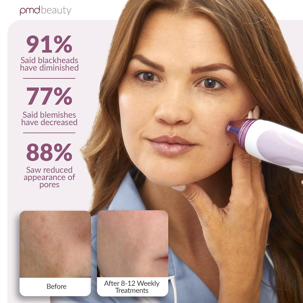 PMD Beauty Personal Microderm Pro - At-Home Use, Facial Exfoliator Tool, Microdermabrasion Machine Kit for Face and Body Skincare