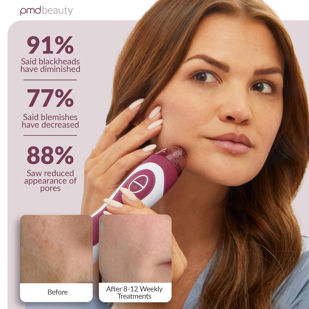 PMD Beauty Personal Microderm Elite Pro - At-Home Use, Facial Exfoliator Tool, Microdermabrasion Machine Kit for Face and Body Skincare