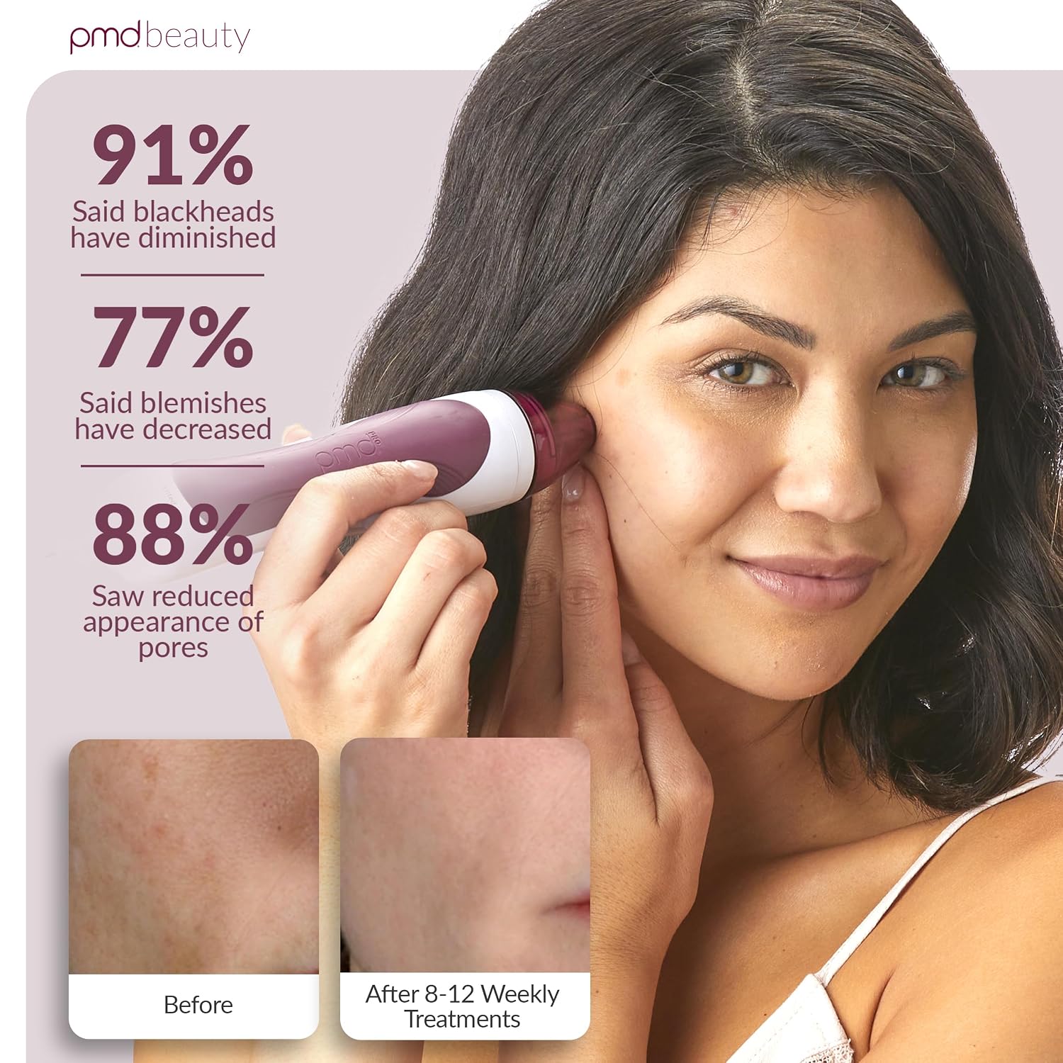 PMD Beauty Personal Microderm Pro - At-Home Use, Facial Exfoliator Tool, Microdermabrasion Machine Kit for Face and Body Skincare