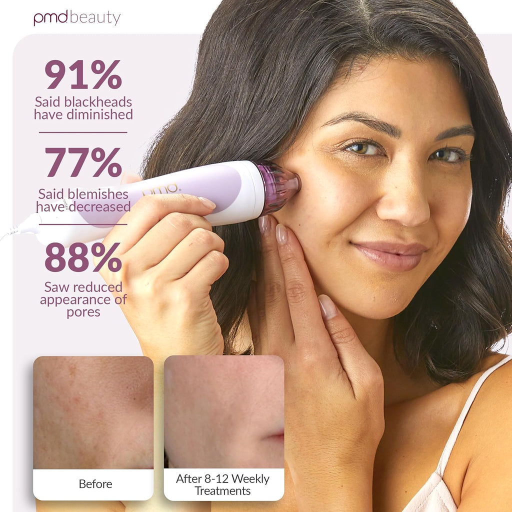 PMD Beauty Personal Microderm Classic - At-Home Use, Facial Exfoliator Tool, Microdermabrasion Machine Kit for Face and Body Skincare