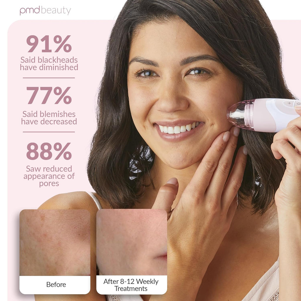 PMD Beauty Personal Microderm Elite Pro - At-Home Use, Facial Exfoliator Tool, Microdermabrasion Machine Kit for Face and Body Skincare
