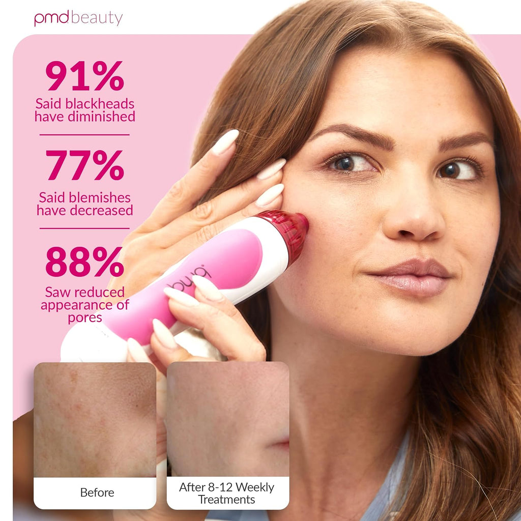PMD Beauty Personal Microderm Classic - At-Home Use, Facial Exfoliator Tool, Microdermabrasion Machine Kit for Face and Body Skincare