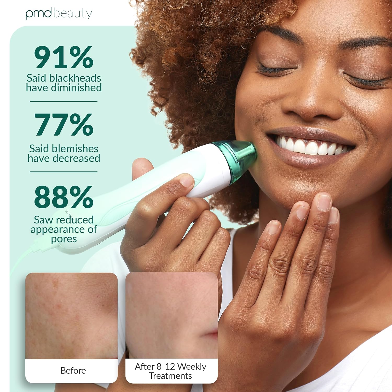 PMD Beauty Personal Microderm Pro - At-Home Use, Facial Exfoliator Tool, Microdermabrasion Machine Kit for Face and Body Skincare